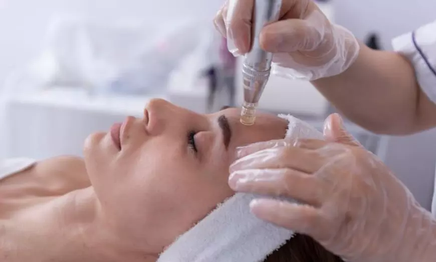 Image 1: Revitalize with One or Two Sessions of Microneedling and LED Therapy!