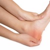 Image 4: 4 Fungal Laser Treatment, 3 Ultrasound or PBM Laser or 1 PRF Treatment