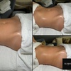 Image 3: Relax w/ One, Three or Five Sessions: Lymphatic Massage 1 or 2 Areas 