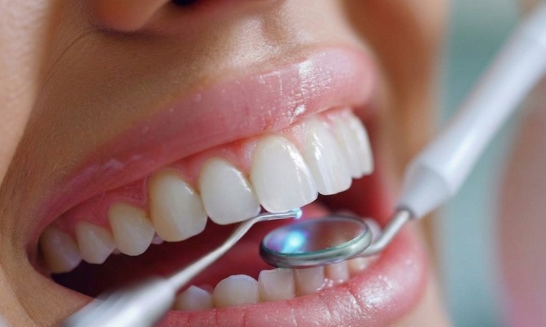 Limpieza bucal con ultrasonido y 1 o 2 empastes dentales