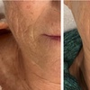 Image 4: 1, 2, or 3 IPL Photo Facials to Target Redness, Pigmentation & Texture