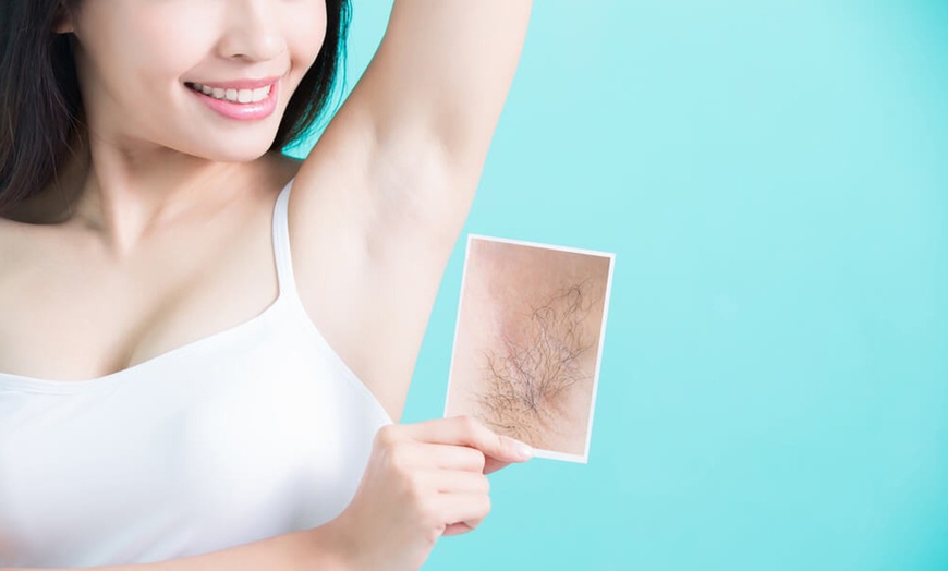 Image 2: 1 Laser Hair-Removal Session - Small,Medium,Large & Extra Large Areas