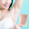 Image 2: 1 Laser Hair-Removal Session - Small,Medium,Large & Extra Large Areas