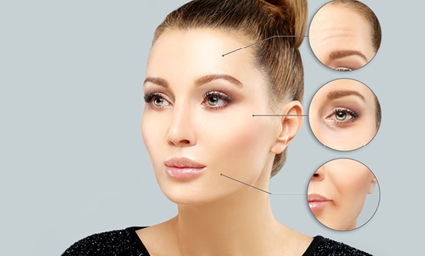 Image 2: Refresh Your Look with 20 or 40 Units of Botox