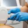 Image 2: Laser Hair Removal Options for Men and Women with Targeted Area