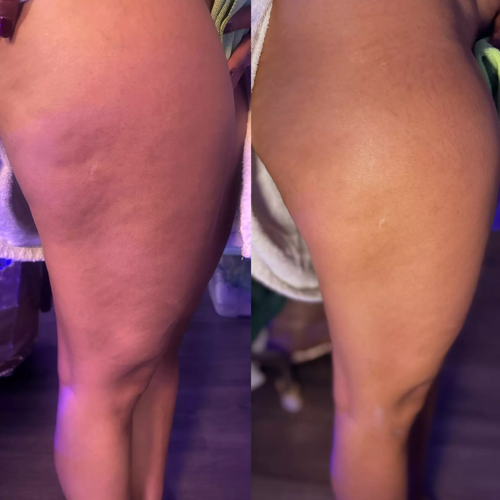 60-Min Lymphatic Massage or 60- or 90-Min Tummy Tightening