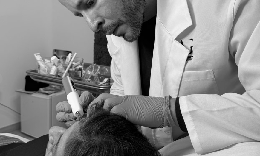 Image 4: Hidratación de labios efecto volumen con hyaluron pen