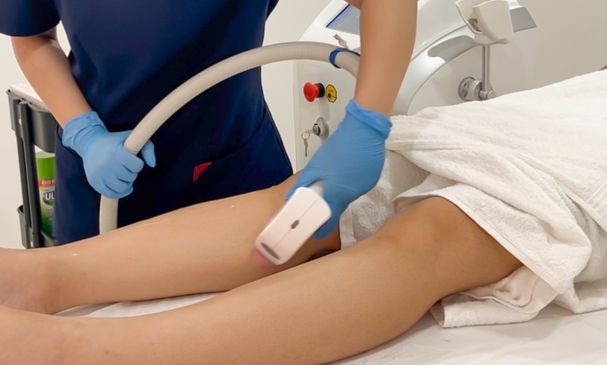Image 4: One Session of Laser Hair Removal on Two, Three or Four Areas