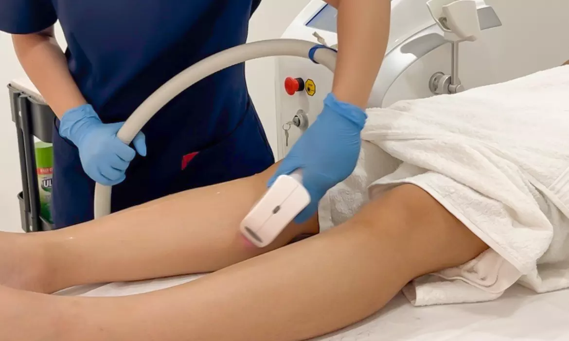 One Session of Laser Hair Removal on Two, Three or Four Areas