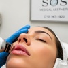 Image 2: Lip Laser Rejuvenation with/wihtout Hyaluronic Acid Filler Options