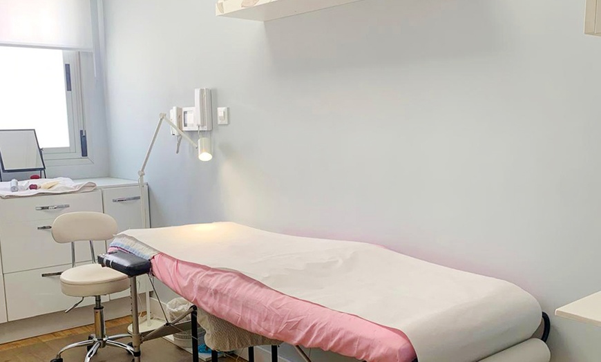 Image 3: Sesión de microneedling facial con Dermapen