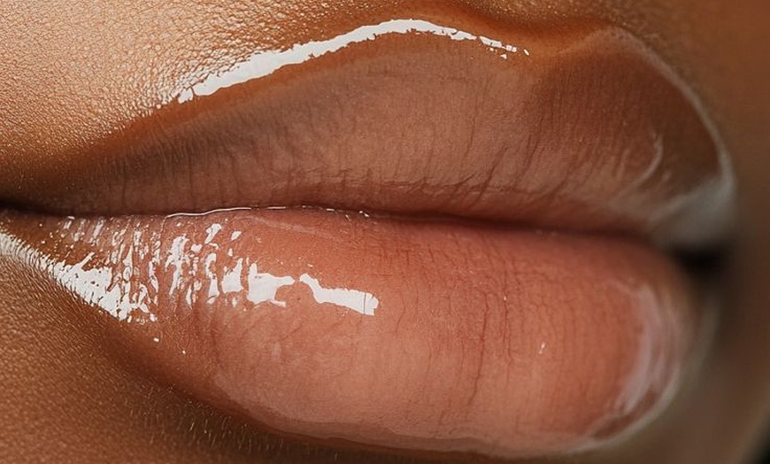 Image 8: Smooth, plump, and refreshed – now enjoy up to 33% off Filler!