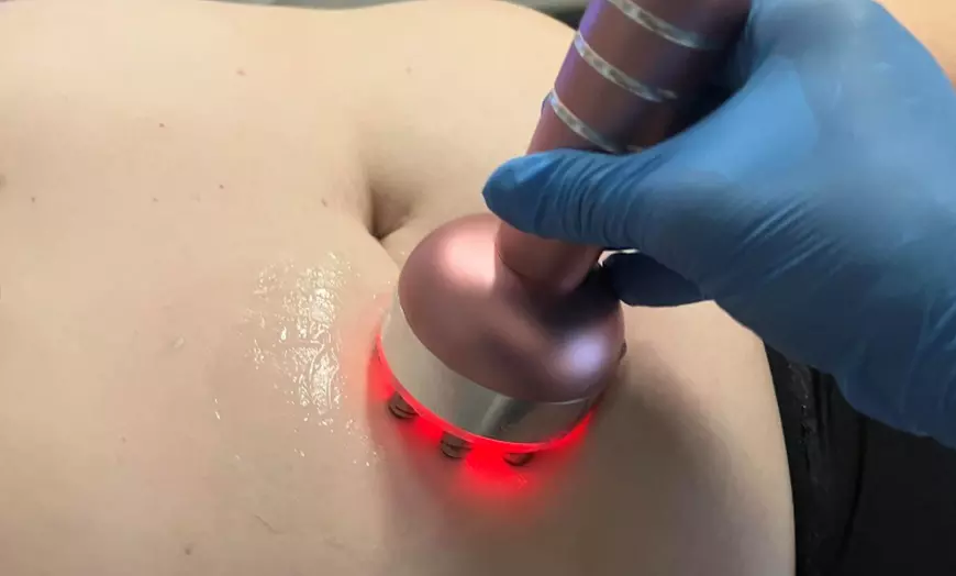 Image 1: 30, 60, or 90-min Fat Cavitation & RF Tightening + Lymphatic Massage