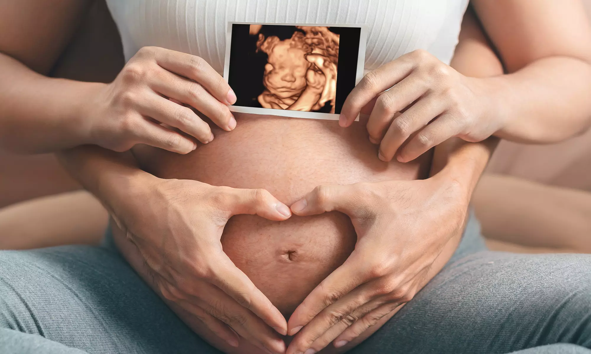 Up to 26% Off on Ultrasound at Las Vegas Baby Face - Primary Image