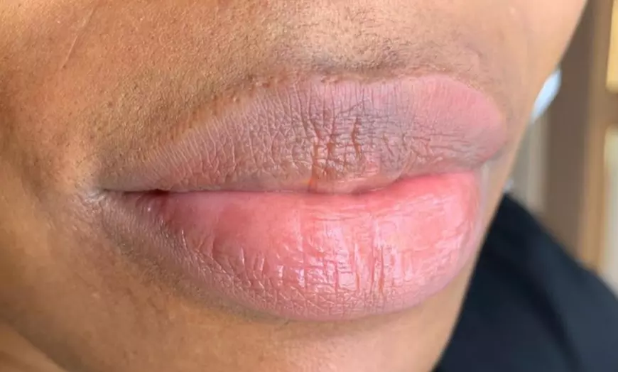 Image 5: Met Semi-permanente make-up vollere strakkere lippen