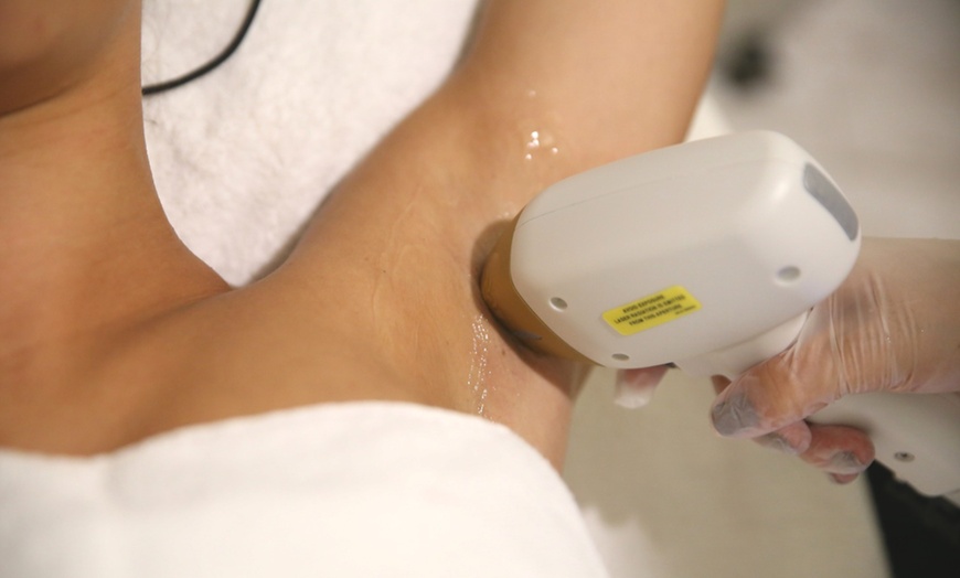 Image 3: Up to 50% Off on Laser Hair Removal at Radiant Touch Skin Care Bar