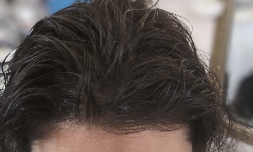 Image 1: Lip, Eyeliner & Brow Tattoos or Scalp Micro Pigmentation Sessions