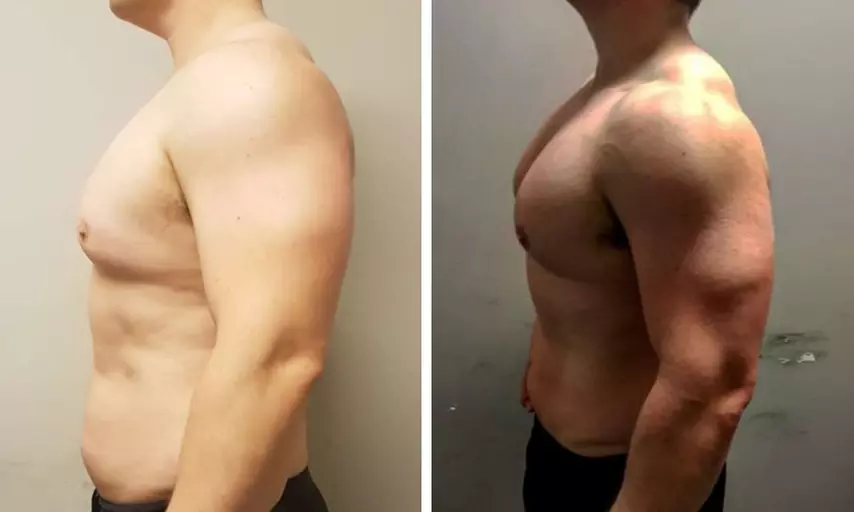 Transform with One Cryoslimming Treatment and Optional EMS Treatments 