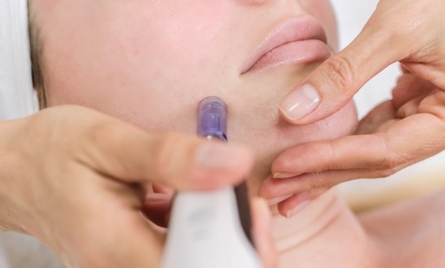 Image 4: Microneedling for Face & Neck or BB Glow Facial with Microneedling