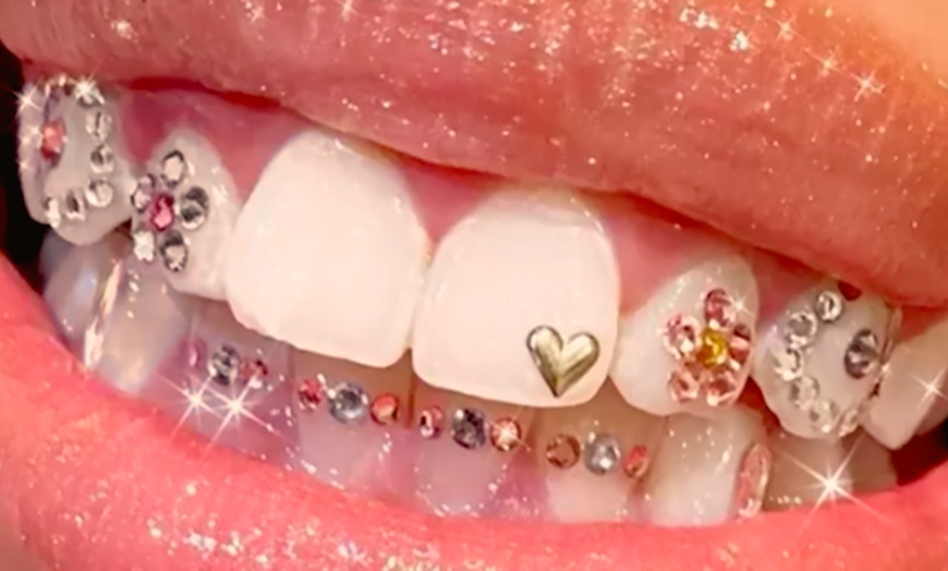 Image 1: Transform Your Smile with Dazzling Tooth Gems