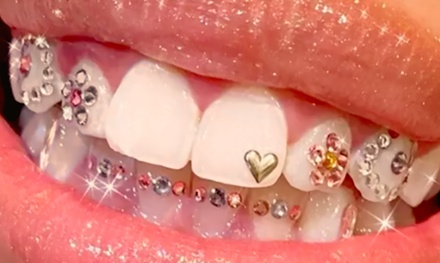 Full Set Sparkle - Tooth Gems - Shaped Secretz