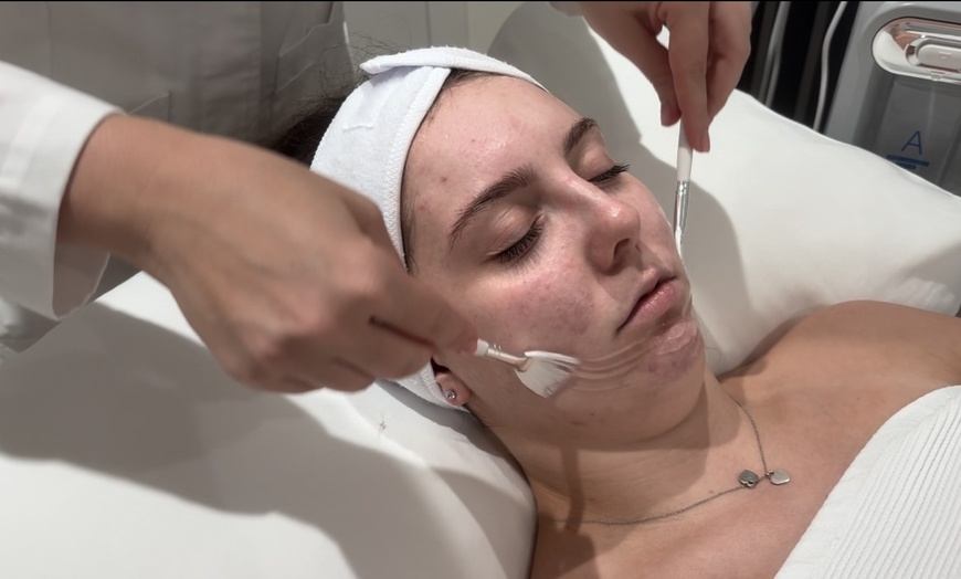 Image 9: Up to 57% Off on HydraFacial at Kolcheva Skin and Laser clinic