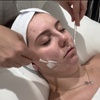 Image 9: Up to 57% Off on HydraFacial at Kolcheva Skin and Laser clinic