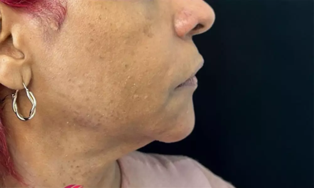 Snag a $100 or $200 Gift Card for Cosmetic Services
