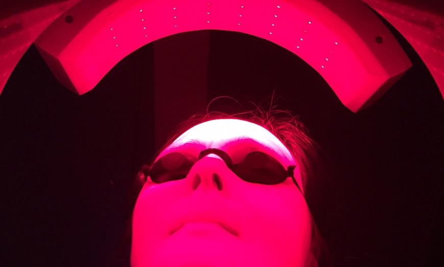 Image 1: 5, 8, 10 Sessions or 6Week Hair Restoration Theraphy for 1 or 2 People