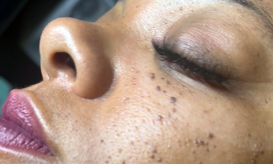 Image 3: Feel Fresh: 1, 3, 5 or 10 Brazilian/Bikini Waxing Sessions