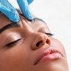 Image 1: Get Natural-Look with 50, 100 or 150 Units of Dysport 