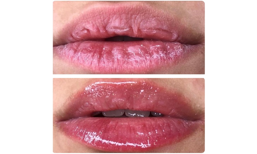Image 1: Hydrating Lip Drip Treatment with/without Color Boost