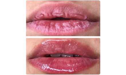 Lip Drip - Pamper Me Pretty Day Spa