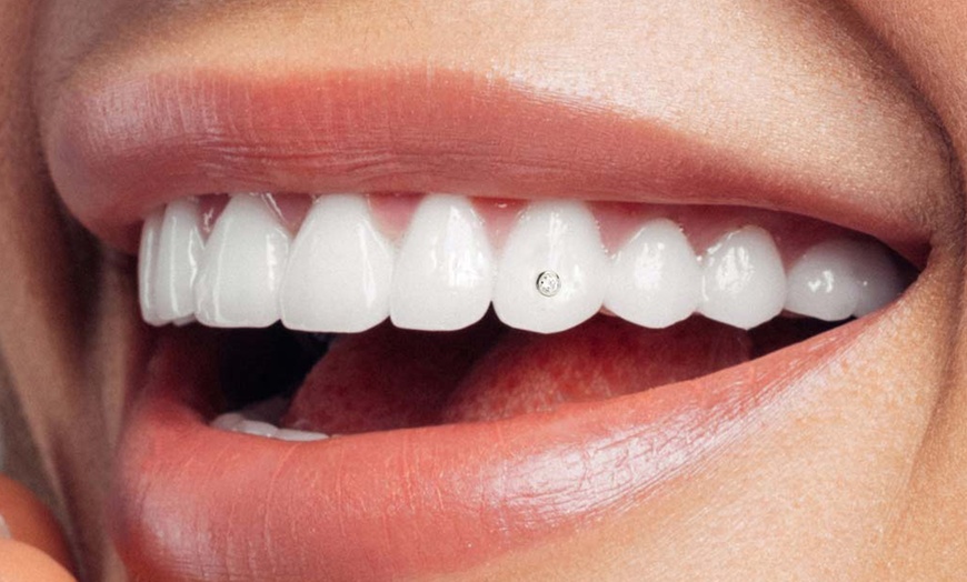 Image 3: Joyas dentales y revisión