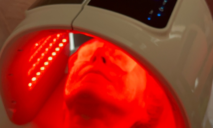 Image 6: Limpieza facial completa con opción a microdermoabrasión y máscara LED