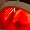 Image 6: Limpieza facial completa con opción a microdermoabrasión y máscara LED