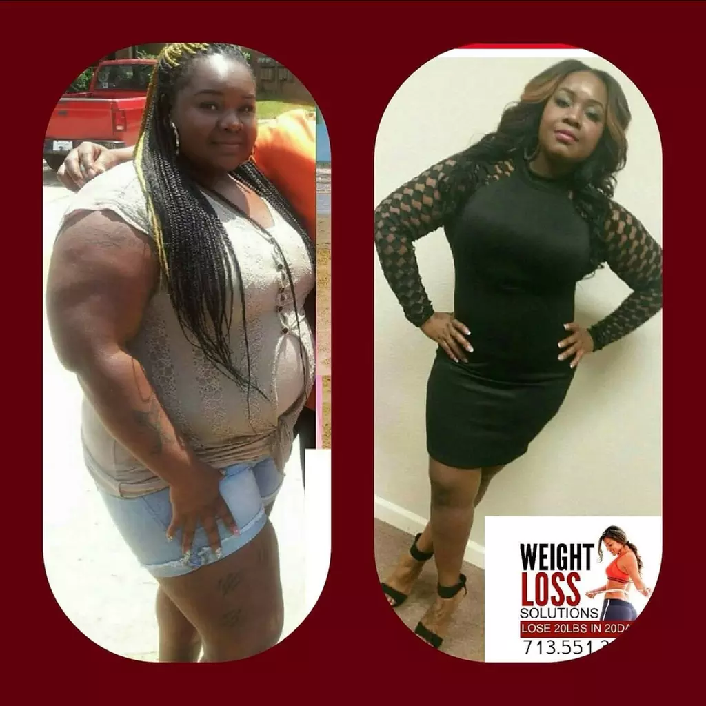 Sculpt Your Body: Laser Lipo Sessions