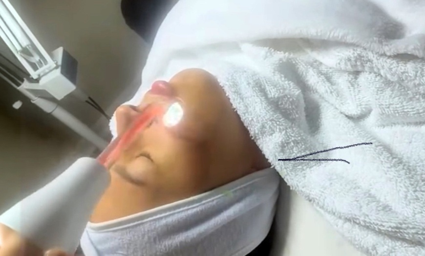 Image 9: Professional Facials & Microdermabrasion for Youthful, Radiant Skin