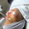 Image 9: Professional Facials & Microdermabrasion for Youthful, Radiant Skin