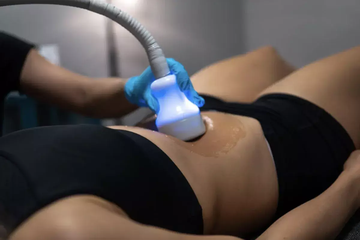 Cryotherapy Sessions for Fat Reduction and Skin Tightening