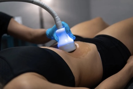 One Localized Cryotherapy Session - MMD beauty space