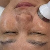 Image 2: Revitalize with 1, 2, or 3 Hydrafacial Diamond Treatment(90- Min)