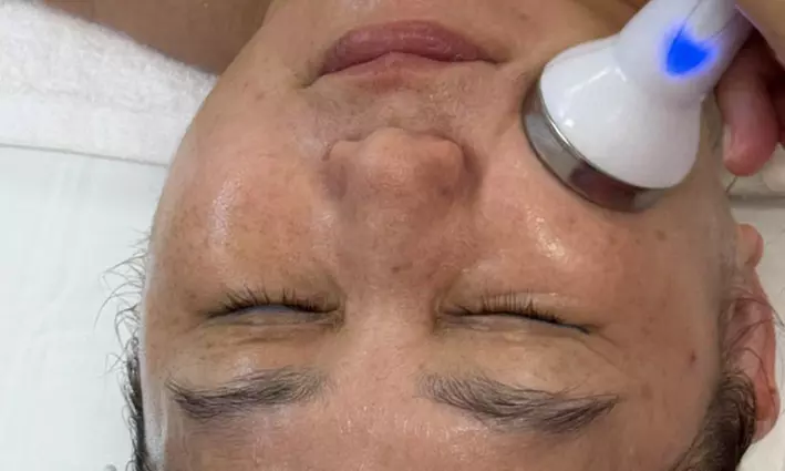 Revitalize with 1, 2, or 3 Hydrafacial Diamond Treatment(90- Min)