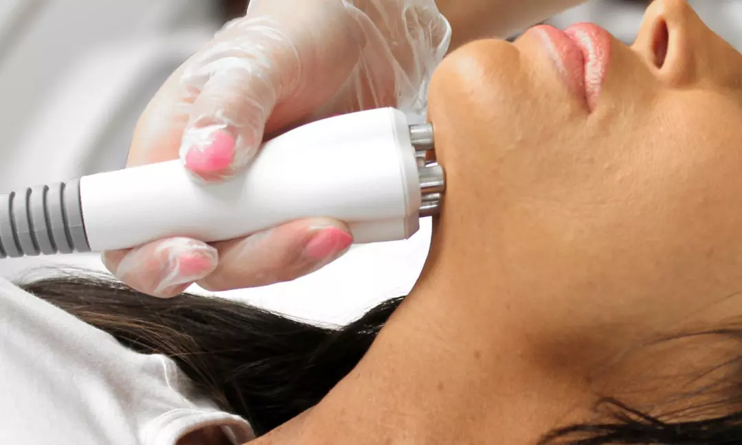 One or Three Venus Legacy RF Skin Tightening Treatments