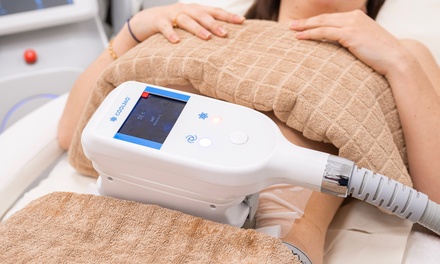 1 séance de cryolipolyse sur 1 zone - SD BEAUTY