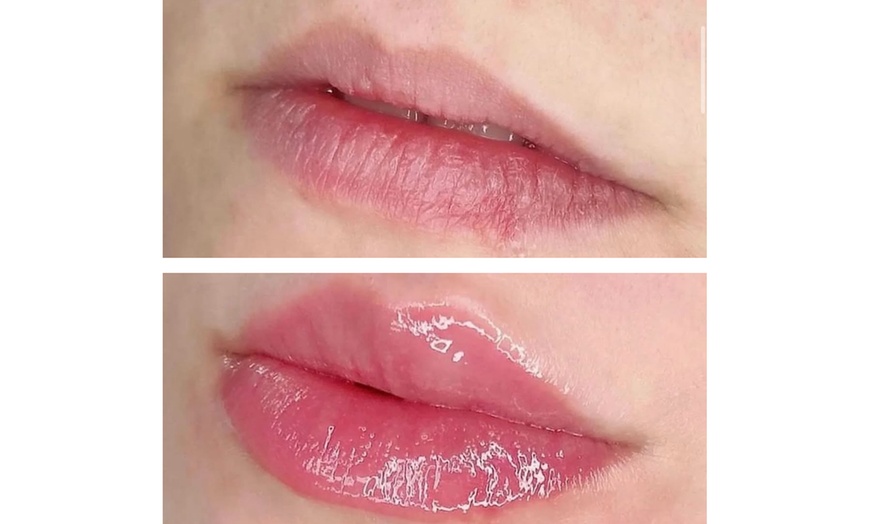 Image 2: Hydrating Lip Drip Treatment with/without Color Boost