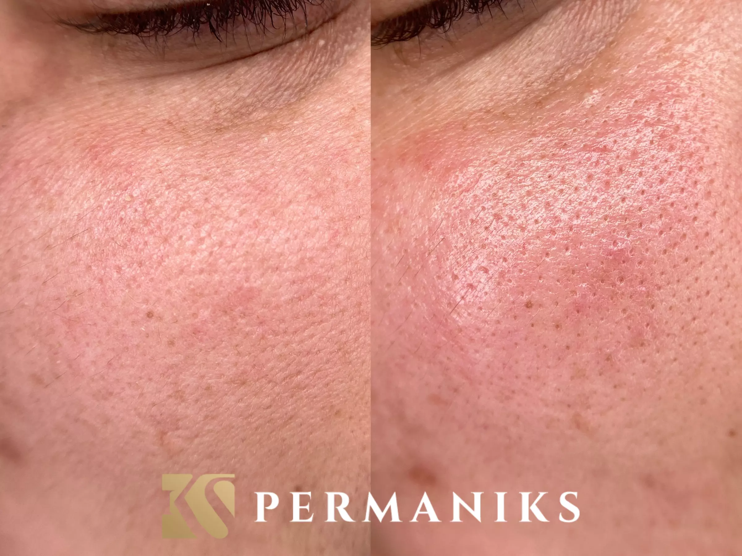 Up to 30% Off on Eyelash Lift & Tint Treatment at Permaniks