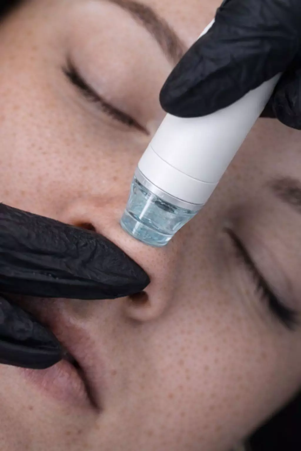 Hydro-Dermabrasion opt. inkl. Boosterampullen & LED-Lichttherapie