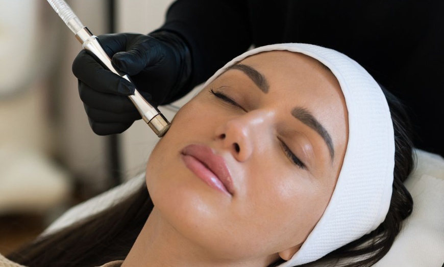 Image 5: Hydrate and Glow Up with Hydrafacial and Skin Tightening