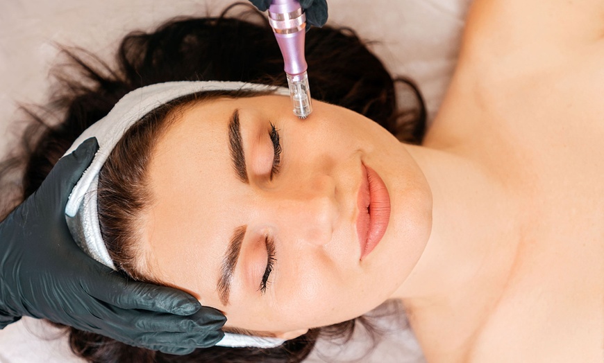 Image 4: Hydroface skin avec microneedling et photobiomodulation en option